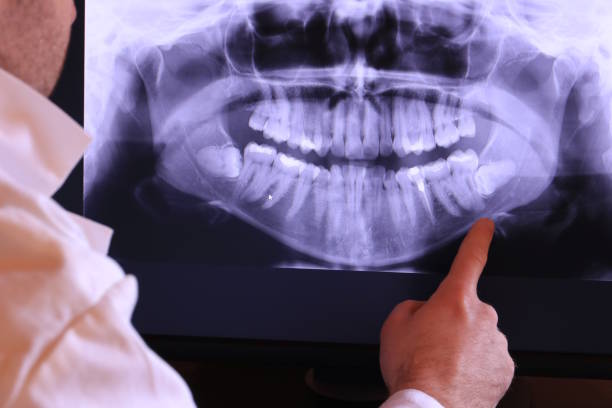 Best Chipped Tooth Repair Near Me  in Floresville, TX