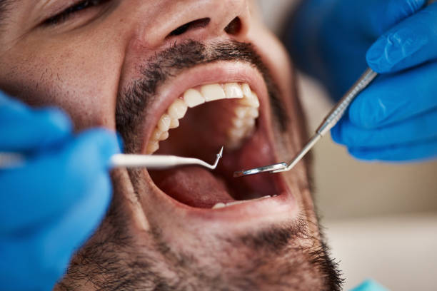 Best Broken Tooth Emergency  in Floresville, TX